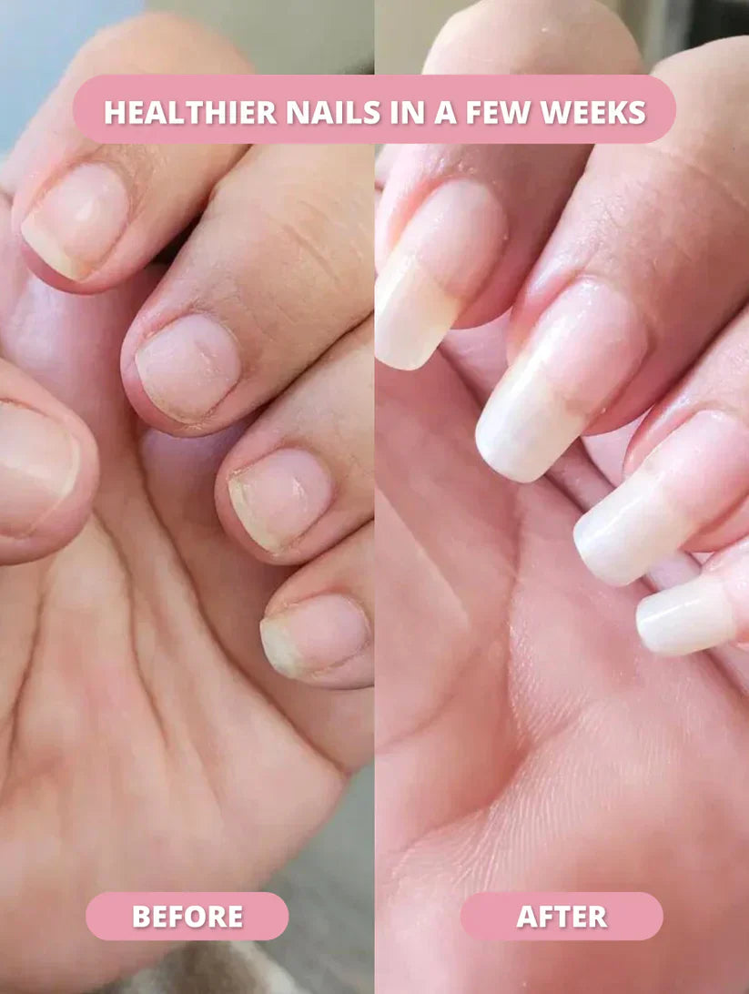 NailBloom™ Cuticle Oil