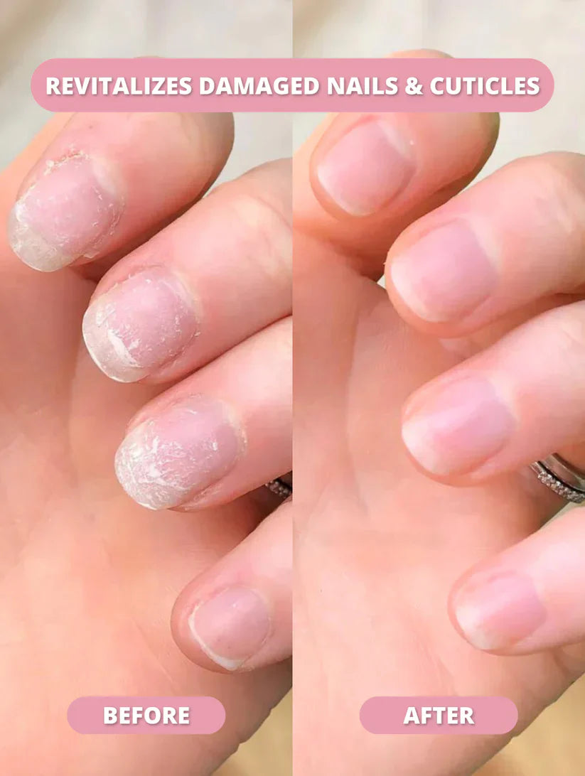 NailBloom™ Cuticle Oil