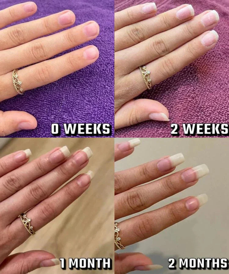 NailBloom™ Cuticle Oil